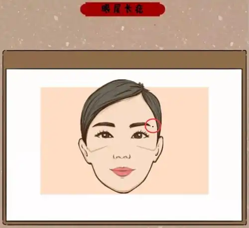  算命的说脸上6大凶相,男人打光棍,女人命苦,一个都别有发展