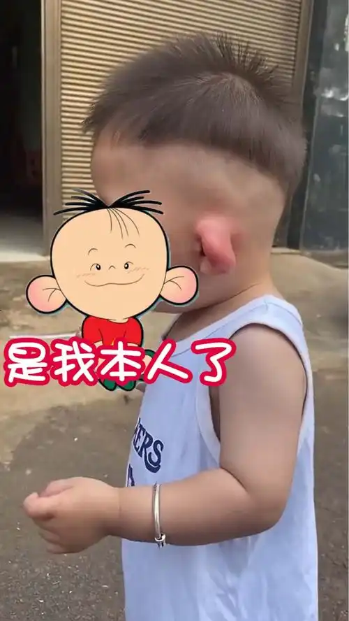  相似度100萌娃被蚊子叮成大耳朵图图画面心疼又好笑