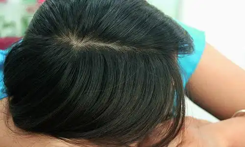  身体出现这几种特征,可别当成小事情,反复出现或许是猝死的前兆