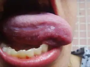  爱滋病的症状,麻烦各位专家