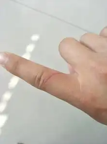 和六个月小狗玩不小心手指被牙划破