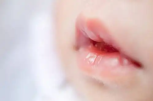 新生儿这些症状属正常现象,新手爸妈看完就放心了