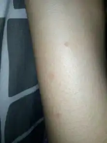  最近腿上出现了很多红点点,不像是蚊子咬的,会痒,有人知道是什么东西咬的吗