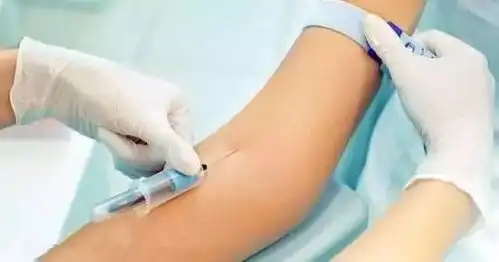  喝水算不算空腹关于抽血的那些事,今天终于搞清楚了