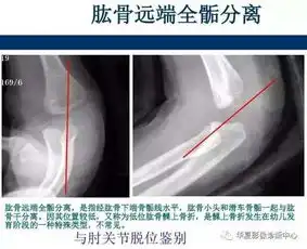  正常胳膊肘x光图片