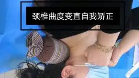 颈椎曲度变直手法矫正  颈椎曲度变直手法矫正