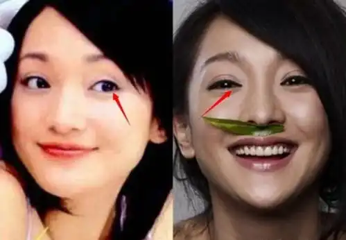 明星频被曝整容前照片,整个容就那么见不得人吗  明星频被曝整容前照片,整个容就那么见不得人吗