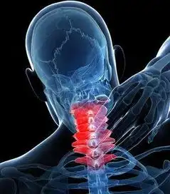 颈椎病图片  颈椎病图片