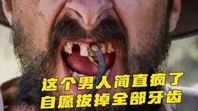  我的一级兄弟瘫痪少年遇到一个智障儿童,喜剧片却看哭了