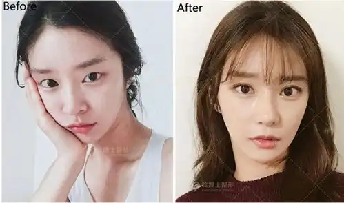  灵动美眸养成记为什么那么多人喜欢双眼皮