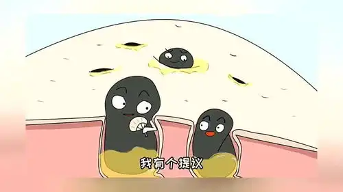  搞笑动漫你用过撕拉鼻贴吗