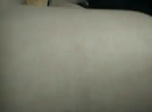  福建有登革热吗这是做什么蚊子咬的