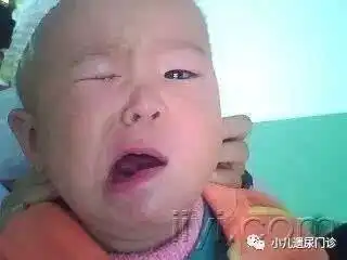  孩子面瘫怎么治春季可是高发季