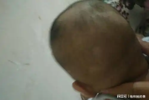 精选问答关于宝宝皮肤护理的这些问题,作为父母的你可要知道