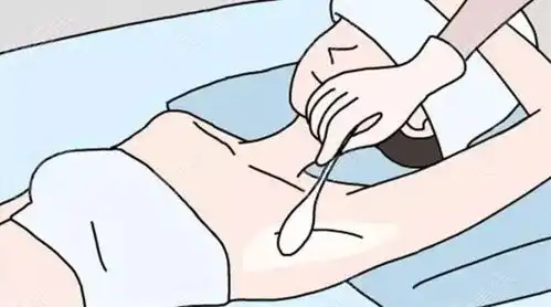  哈尔滨治疗腋臭手术比较好的医院排名前三家做微创狐臭手术正规费用5千起