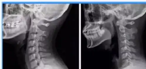 都说乳胶枕好,为什么那么多人睡了之后不舒服难道是因为这个原因  都说乳胶枕好,为什么那么多人睡了之后不舒服难道是因为这个原因