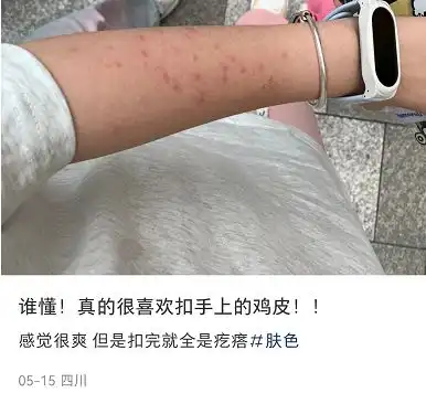  有它,糙胳膊老腿的小疙瘩有救啦