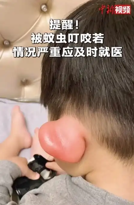  e句话看天下丨工作焦虑易上头,沈梦辰都斑秃了