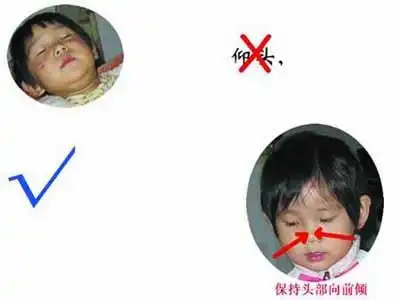  20条家庭急救小知识,快为家人收藏起来