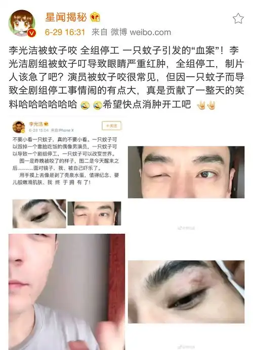 被蚊子叮的搞笑图片李光