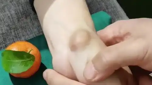  手上鼓了一个大包,老大爷这样一按瞬间没了,这技术果然不是吹的