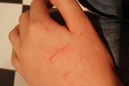  猫把主人抓破相,竟没有一丝愧疚