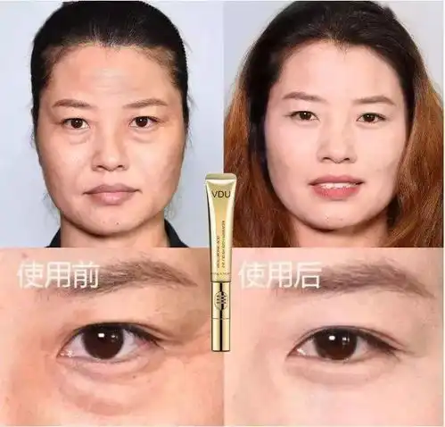  无论你眼袋黑眼圈有多大多深,用它一抹,70岁前都有救