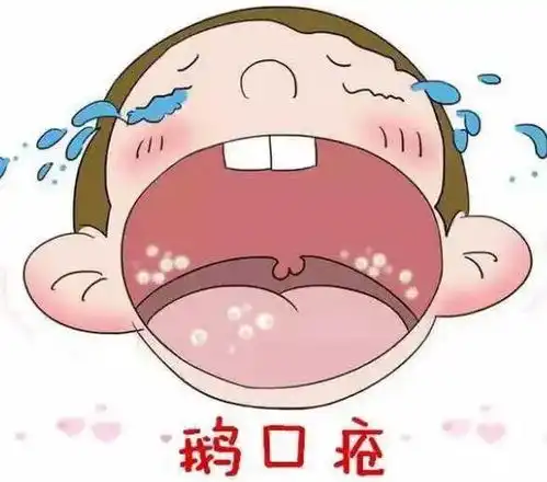  科普防疫丨出行不便,宝妈们如何防止宝宝出现鹅口疮