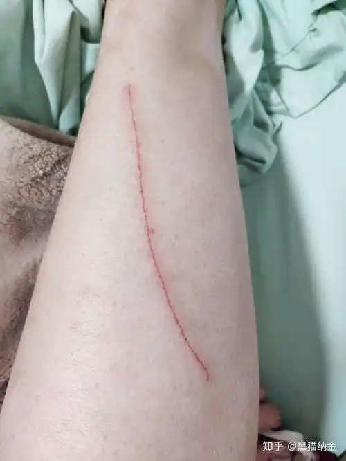养猫被猫抓伤的图片