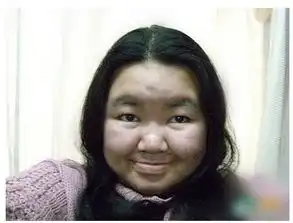 求小月月真实照片  求小月月真实照片