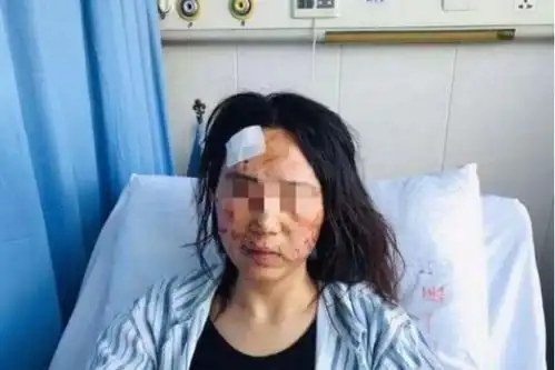  女子结婚陪嫁200万,婚后被丈夫当街殴打有些人,不值得你原谅