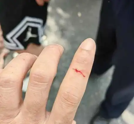  惊险危急时刻,这位民警徒手夺刀