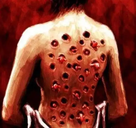  十宗罪玉米男孩真实事件,密集恐惧症人群慎入