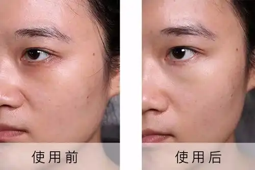 黑眼圈真人图片