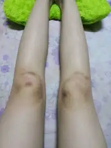  找几张女生小腿流血的图片,骗我男朋友