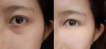  贴上它,15分钟清凉明目,黑眼圈老眼袋重眼纹,眼睛干痒涩都消失了