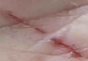  超市看衣服不小心划破手女子要求赔偿我不能上班做饭怎么办