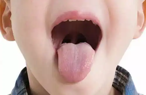  警惕舌头出现这些症状,表示宝宝生病了