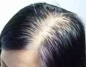  发立芳龙抬头,剃喜头,油腻如我却无发可剃