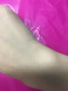  最近总是冒这种白色的坨坨,很痒,长得像蚊子咬的,但是没多久就消到只剩一个红点,请问是什么虫子咬的