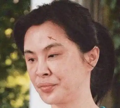  818那些整容失败的前当红女星红颜自古如名将不许人间见白头