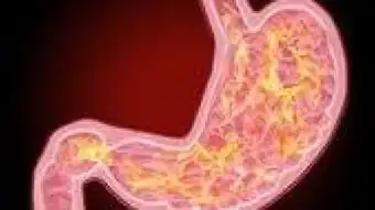 该吃药的图片搞笑肝囊肿