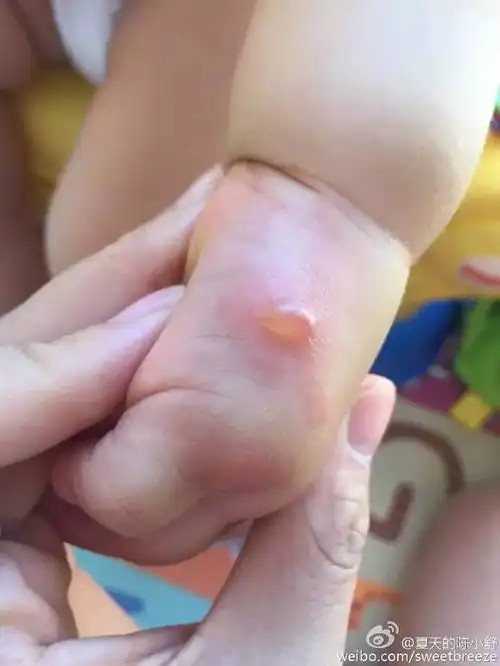  当孩子生病时,别问度娘,问这些医生