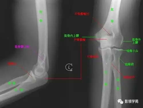 肘关节x片正常图片