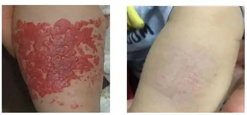  华西医院这个最神秘还最吓人的核医学科,到底搞了些啥子硬核事情