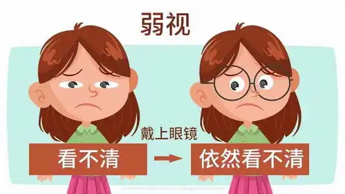  早发现早治疗,儿童弱视的几大信号