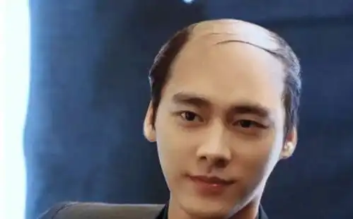  为什么很多秃顶的人,宁愿周围留一圈头发,也不愿剃成光头
