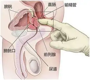 正月剪头搞笑图片前列腺