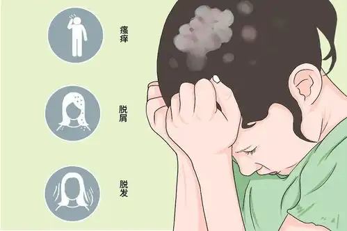  儿童脱发小心头癣