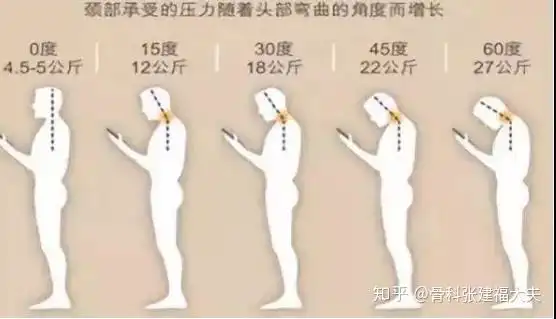 颈椎曲度变直那么可怕,你真不考虑纠正下  颈椎曲度变直那么可怕,你真不考虑纠正下